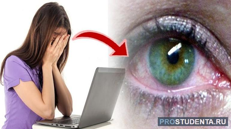 Вредное воздействие компьютера на глаза